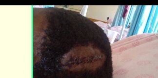 Eastern Cape Education MEC Condemns Assault of Shushu High School Learner Eastern Cape Education MEC Condemns Assault of Shushu High School Learner