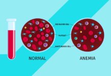 Learn More About Iron-Deficiency Anaemia need to know about iron deficiency anemia